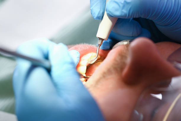 Best Weekend Emergency Dentist in Corsicana, TX