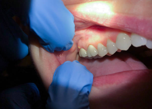 Best Emergency TMJ Treatment in Corsicana, TX