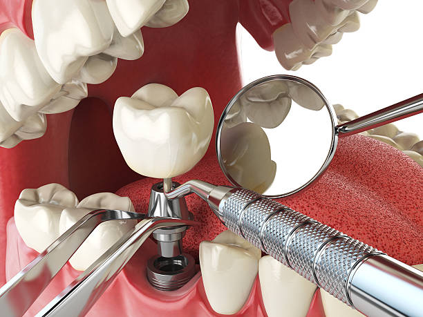 Best Same-Day Emergency Dental Services in Corsicana, TX